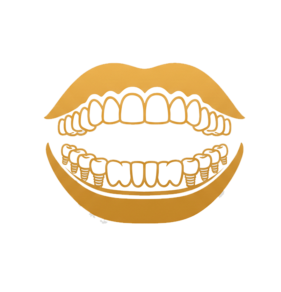 close up of full mouth dental implant